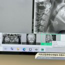 플러스원치과교정과치과의원 | 인천 구월동(연세바로교정치과) 내돈내산 치아발치교정 후기 및 기록 스타트 🦷