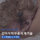 24시스마트동물메디컬센터 | [24시송도오케이동물메디컬센터] 강아지 피부 종괴 제거 및 스케일링