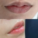 헤어팝콘 이미지