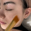 보람씨티프라자 | 검단 원당동 기미관리 비비드엘 인천점 잡티관리 받은 후기