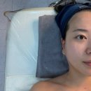 신림 피부과 고민하다 결국 여기 정착 (당일 효과 리프팅 후기)