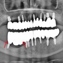 동그라미 치과기공소 이미지