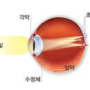 신사콘택트렌즈 | 난시가 많아 눈의 피로가 심하시다면? 클래리티 난시 대용량 처방사례[다비치 안경 신사역점]