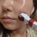 구십구퍼센트 | [에끌라엘] PDRN 앰플 케어 후 피부탄력 솔직 후기