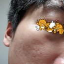 오늘봄한의원 | [내돈내산] 이대역 사월의봄 한의원 - 새살침 2회차 후기(여드름 흉터 채움침)