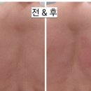 바른선 테라피