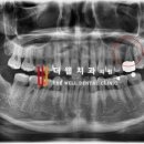 더웰치과의원 네이버블로그