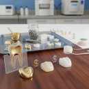 참치과기공소 | 인레이 가격, 금 vs 세라믹 3군데 견적 비교 후기 (2024년 기준)