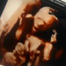 어니스트여성의원 | [ 육아 / 출산 ] : 임신 중기 16주 차 입체 초음파 후기