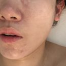 정든 | 익산 신동 피부관리실 정든에스테틱 웨딩관리 후기