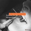 오알프치과의원 | 오알프치과 부분교정 리얼후기