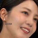 대전 치아미백 2차 후기 | 연세맘편한치과의원 재방문 후기
