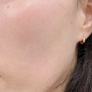 바이오빌딩 | 클로이에스테틱 바이오포톤 순환 관리 내돈내산 후기