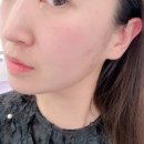 #당산피부관리 마고스킨에서 퍼스널 피부관리