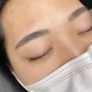 이지아이반영구 네이버블로그
