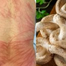 누가 복지용구 이미지