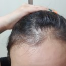 엠디(MD)헤어