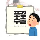 우성비뇨기과의원 | 까치산역비뇨기과 슬리브포경수술, 흉터 최소화 절개 노하우
