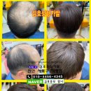 김호증모가발탐나