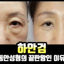 눈밑성형하고 엄마가 젊어졌다 #하안검 #효도성형 #Mommy makeover 이미지