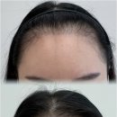 스테이 무아 이미지