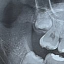 쏙쏙사랑니치과의원 이미지