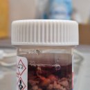 중앙비뇨기과의원 | ​[건강기록] 을지로 이윤수 비뇨기과, 전립선 비대증 수술(TURP) 생생 후기