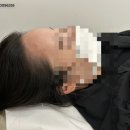 헤어라인 이미지