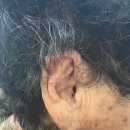 포낙보청기 대구센터 이미지