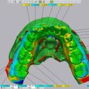 샤인 치과기공소 이미지