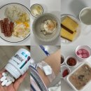 4공단로1L-18 | [ 일상 ] 용종 5개 나오고 1년만에 대장내시경 재검 후기