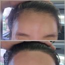 희헤어라인 이미지