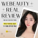 소나무 | 광주피부관리 위뷰티광주점 내돈내산 후기이벤트 70만원 상당 관리권 혜택