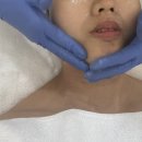 [평택] 고덕피부관리 디또뷰티 고덕삼성점 | 슈퍼젝션 관리 후기