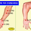 암.병을 이긴 사례 모음 이미지