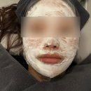 [인천/영종] 닥터스피부과의원 인천영종점 스킨부스터 리쥬란 vs 쥬베룩 비교 시술 직후 사진, 후기!