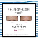 이명철성형외과 - 전주시 완산구 충경로 38 | 이명철성형외과
