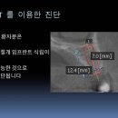 성북이엔이치과 이미지