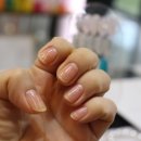 포스네일(4'S-NAIL)