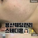 스테디윤
