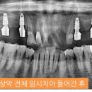 연세바른치과 이미지