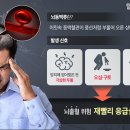 머리에서 갑자기 ‘이 느낌’ 들면 3명 중 1명 사망하는 “초응급 상황” 이미지