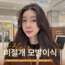 모델헤어라인 - 완주군 | 강남 비절개 모발이식 후기 헤어라인교정 1년 변화정리