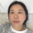 늘미쁨스킨 | 평택고덕 피부관리 ' 늘미쁨스킨 ' 모공관리 후기