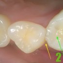 상주치과기공소 이미지