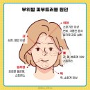 [트러블 피부의 원인, &#39;변비&#39; 없애는 음식 7가지 ] 이미지