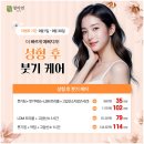 코편한한의원 | 코성형 후 붓기 걱정된다면 얼굴 붓기한의원 치료는 어떨까