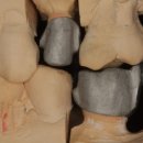 민치과기공소 이미지