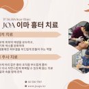 술이마시따 | 이마 흉터 제거 후기 | 술마시고 넘어짐 이렇게 위험합니다.