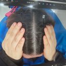 맥스웰피부과의원 | 🧴 [맥스웰피부과 강남점] 탈모치료 W1 D 프로그램 💆‍♂️ 4개월 리얼후기